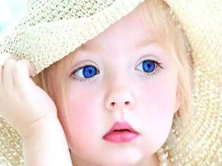 God Is Great: See 25 Photos of Little Kids That Were Born with Unusual Eyes