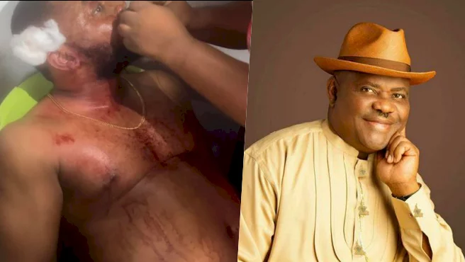 Lead singer of Governor Wike's band survives motor accident (photos)