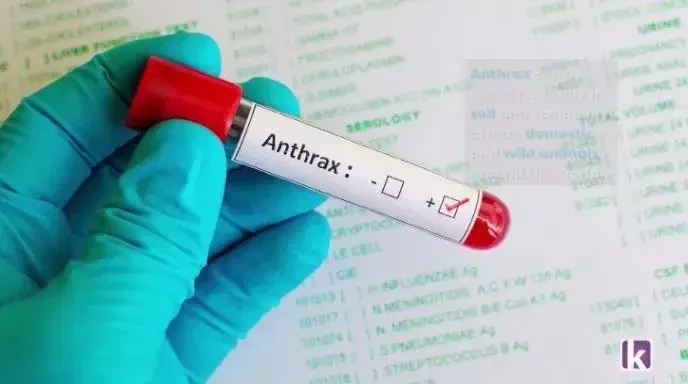 FG alerts Nigerians over outbreak of anthrax in Zamfara