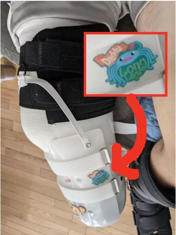 A sticker on someone&#x27;s brace