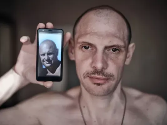 Before and after photos of tortured Ukrainian war prisoners who lost up to 40kg body weight during 2-year Russian captivity