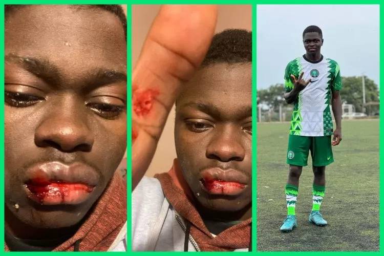 Like Didier Drogba warned, Nigerian starlet Moses Jerry beaten by fake Serbian football agent - The Full story