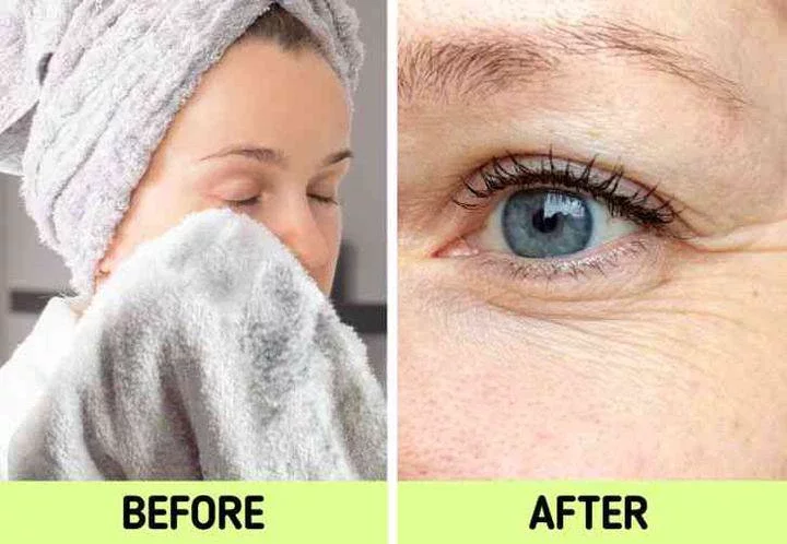 See Reasons Why You Shouldn't Use a Towel to Dry Your Face