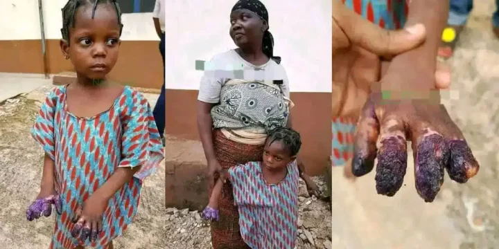 Grandmother arrested for burning granddaughter's hands after she ate Indomie Grandmother arrested for burning granddaughter's hands after she ate Indomie