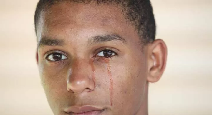 Crying blood and 5 other strange things that can happen to your eyes