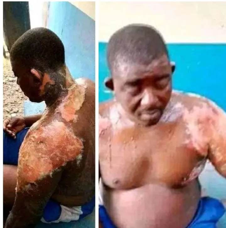 Woman pours hot water on her husband in Niger State
