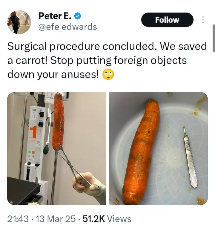 Doctor raises alarm as he shows foreign object he took out of a man's body