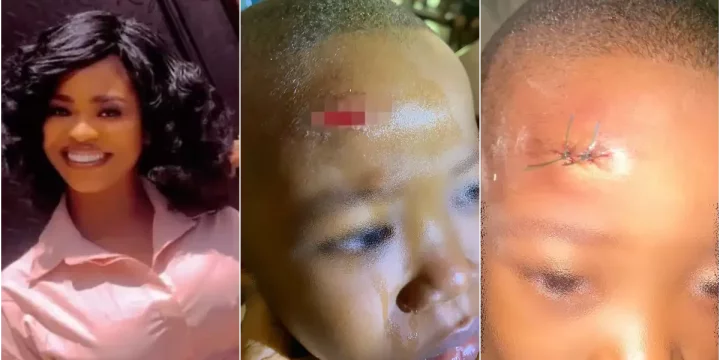 Mother cries out over scar on son inflicted by classmate at school