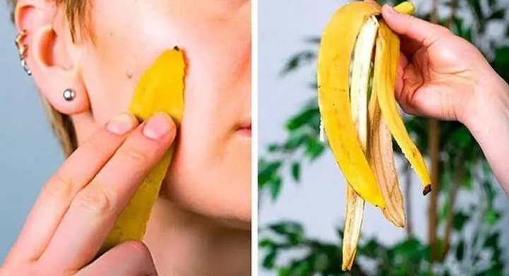 5 amazing benefits of banana peel you should know