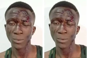 Police arrest notorious armed robber for stabbing victim over iPhone in Abuja