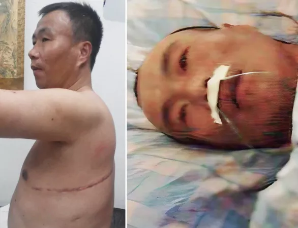 Chinese organ harvesting victim woke up chained to bed with parts of liver and lung missing