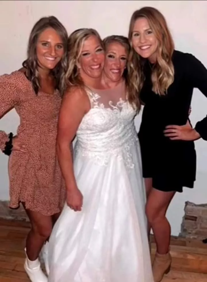 Conjoined twin Abby Hensel, from Abby & Brittany, weds