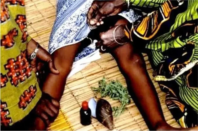 The horrors of female genital mutilation and infibulation