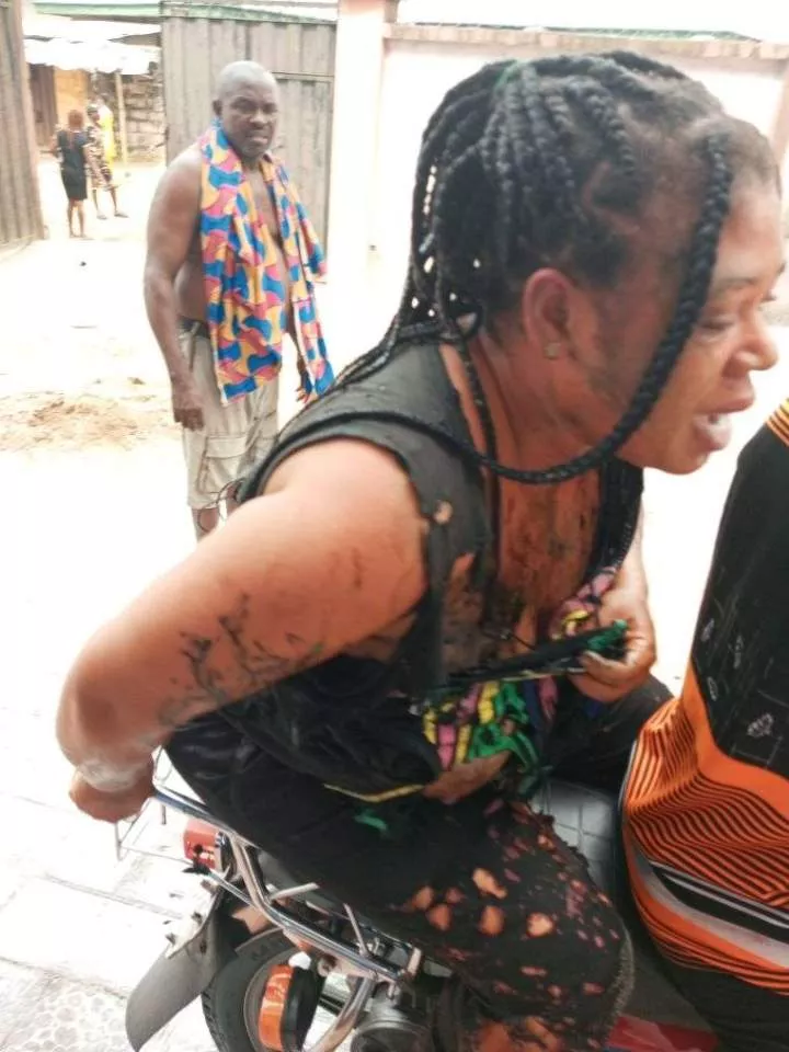 Man reportedly pours acid on his wife in Rivers