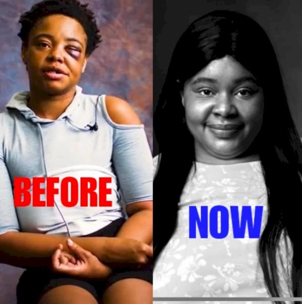 Amazing Transformation Of Girl Who Was Ruined By Crack (Photos)