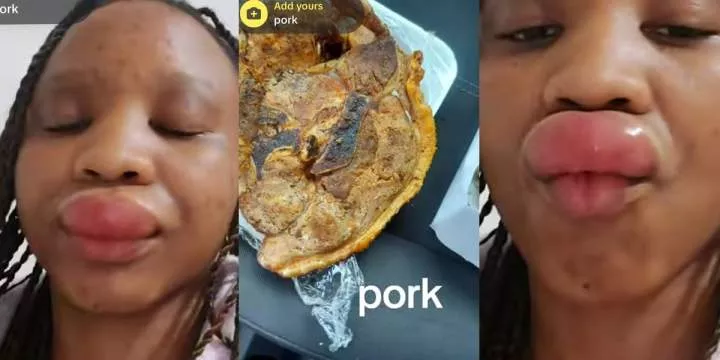 Nigerian woman develops allergy after eating pork, shares shocking video on social media