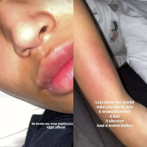 You're an abuser, liar, cheat - Maduka Okoye's estranged girlfriend drags him to filth and shares bruised up photos of herself