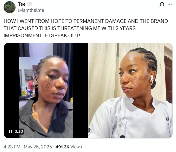 Lady accuses aesthetic clinic of permanent scar following skincare treatment