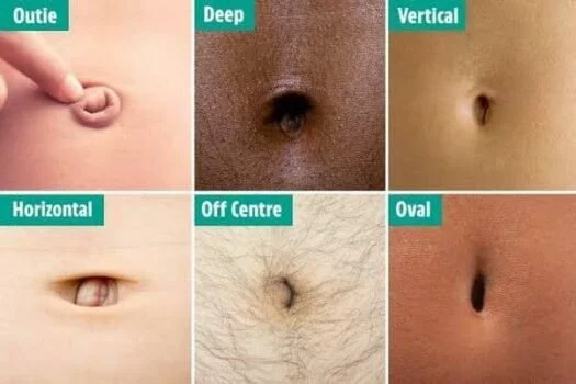 Six types of belly buttons