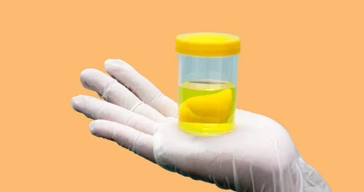 Urine is normally a shade of yellow 