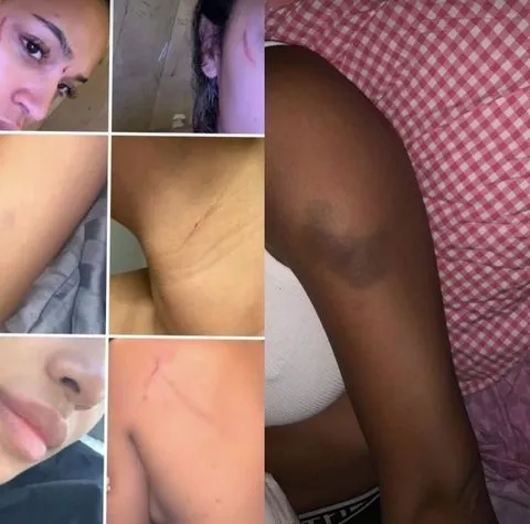 You're an abuser, liar, cheat - Maduka Okoye's estranged girlfriend drags him to filth and shares bruised up photos of herself