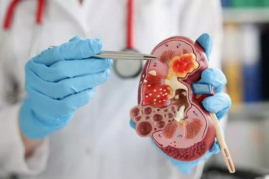 5 Signs Of Swollen Kidneys That Should Not Be Ignored