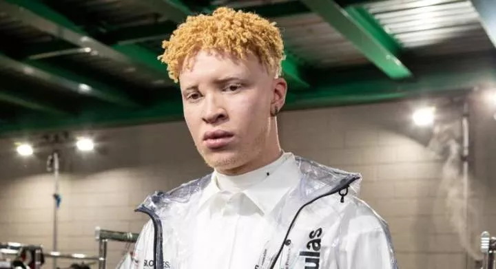American albino model Shaun Ross [Getty Images]