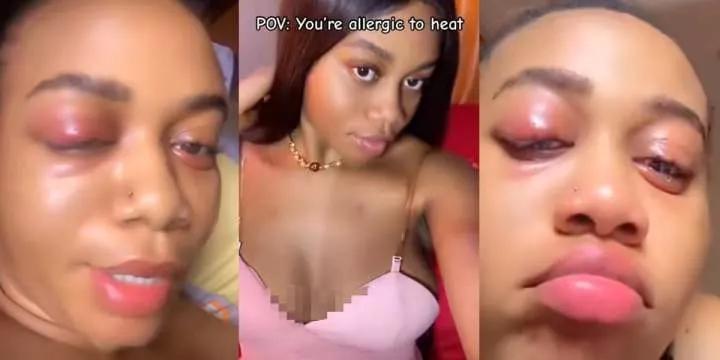 "You sure say na heat, abi na hit?" - Beautiful Nigerian lady's heat allergy reaction stuns online users