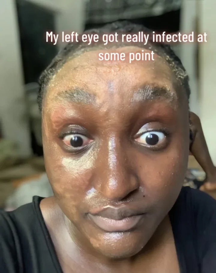 'How lab experiment ruined my face during final year project' - Newly inducted pharmacist
