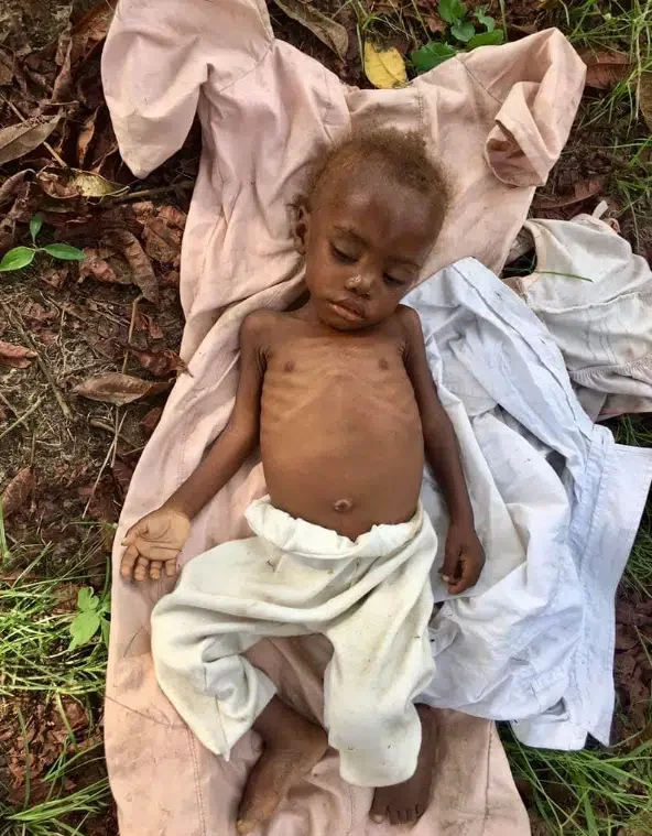 Amazing transformation of toddler who was rescued after being abandoned as a 'witch' goes viral