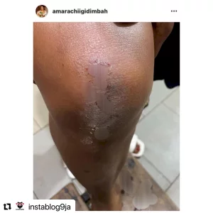 How God kept my baby alive in my womb for 8hrs after I almost d#ed on the way to the hospital - Actress Amarachi Igidimbah