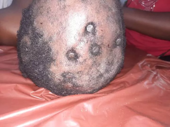 Graphic photos of unconscious man found with several nails driven into his skull