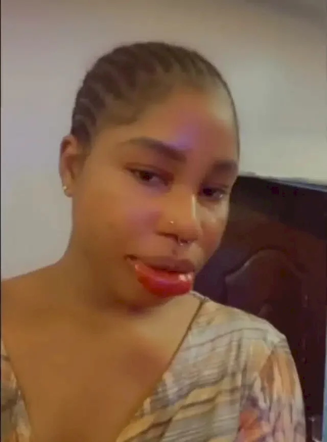 'I never knew it'd be like this' - Lady laments after attempt to get pink lips (Video)
