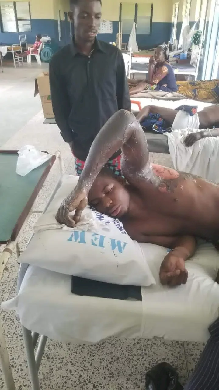 AKSU student hospitalized after he was allegedly set ablaze by community resident amid fierce argument