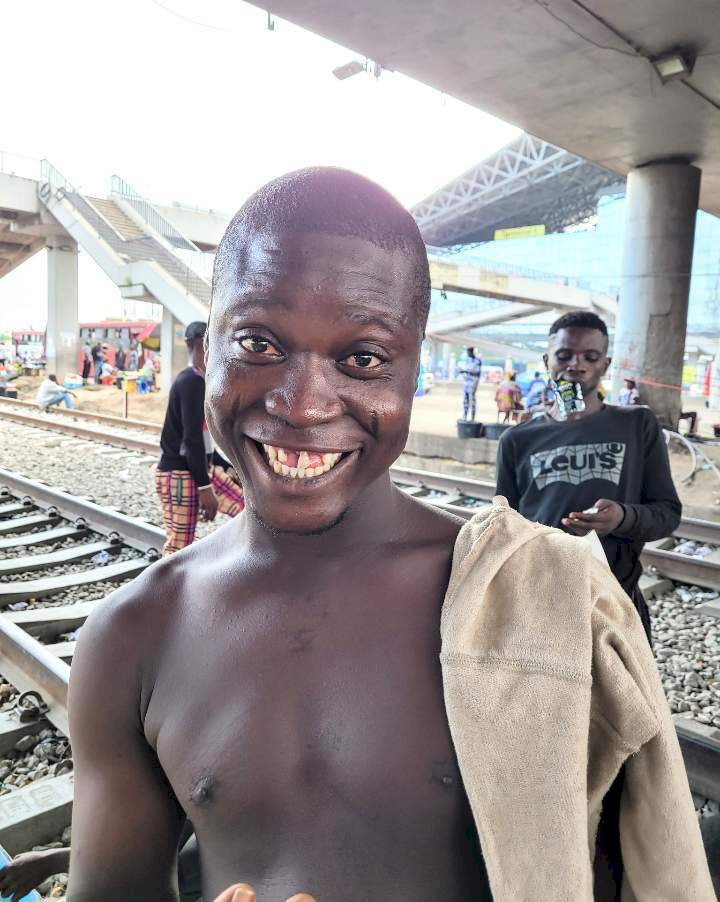 Man who felt insecure about his teeth can't stop smiling after a philanthropist took him to a dentist (Photos)