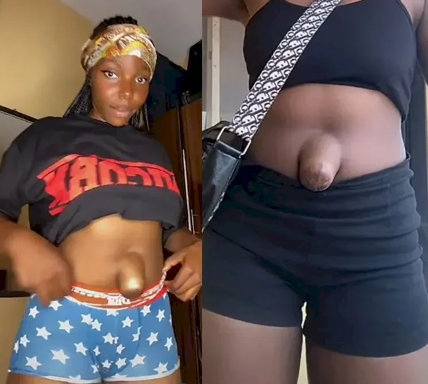 Nigerian woman with protruding belly button goes viral as she proudly shows it off