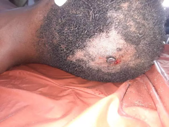 Graphic photos of unconscious man found with several nails driven into his skull