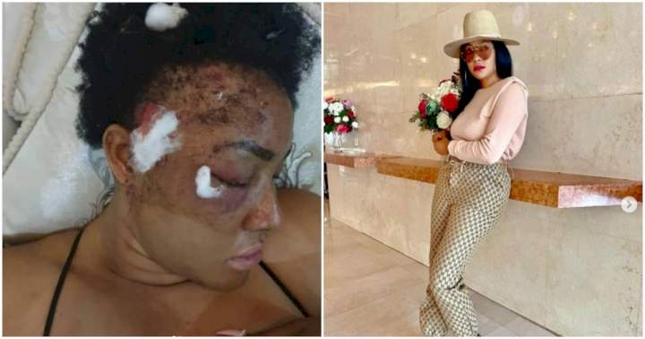 "After two years plus that I was shot, pellets still coming out" - Angela Okorie recounts her near-death experience with gunmen
