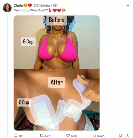South African woman proudly shows off result of her breast reduction surgery
