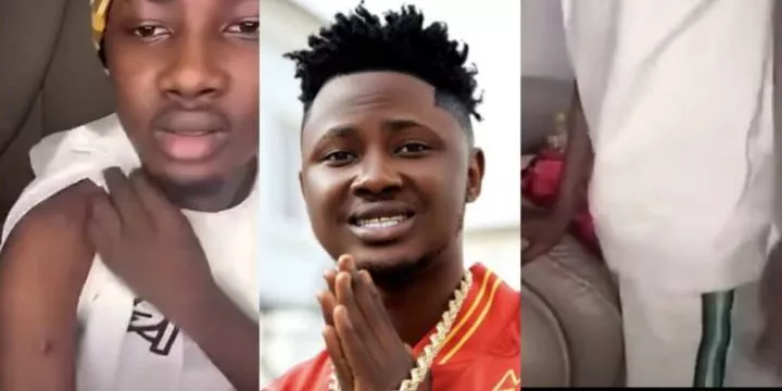 Salo reveals bullet wounds weeks after being shot 3 times in Lekki, says he can't walk properly again