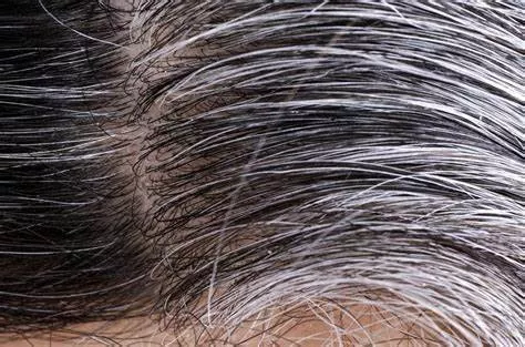 Say Goodbye to White Hair with These Natural Remedies