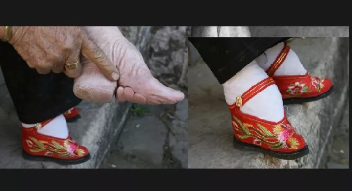 Foot binding in China [openendedsocialstudies]