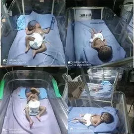 Drama As Man Faints After His Wife Delivered Triplets In Kogi
