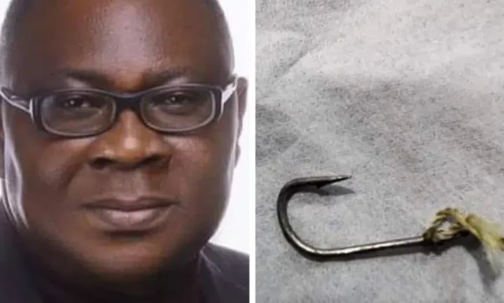 Man narrowly escapes swallowing metal hook in soup while eating at a funeral