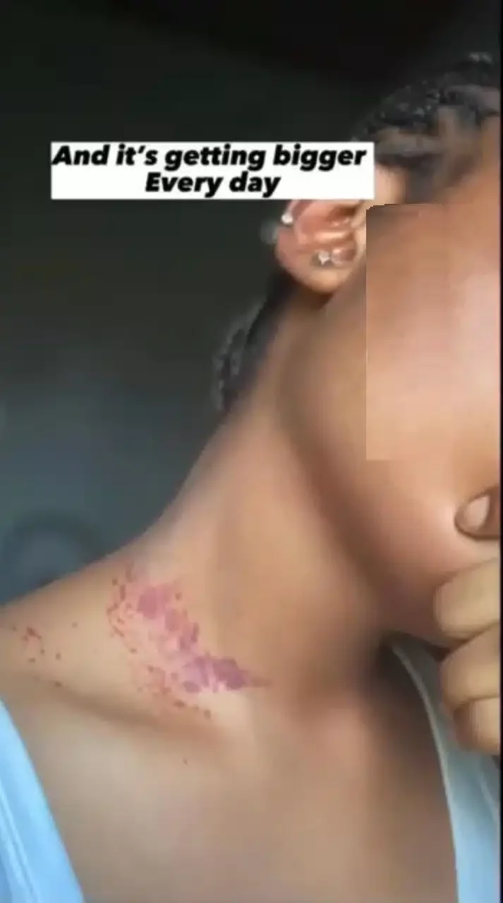 'I use it everyday' - Lady cries out over side effect of contraceptive pills on her skin