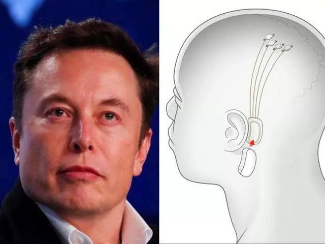 Elon Musk's Neuralink to start human trial of brain implant for paralysis patients