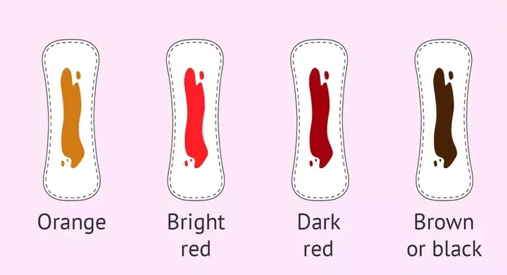 What every colour of your menstrual blood says about your health