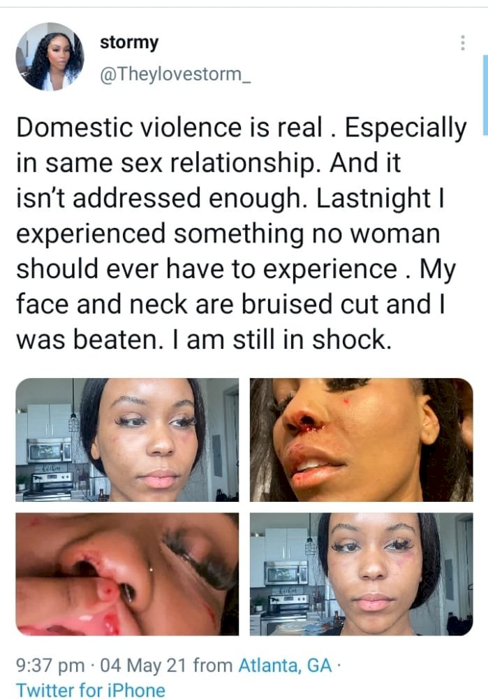'Domestic violence is real especially in same gender relationship' - Lady cries out after being battered by her girlfriend