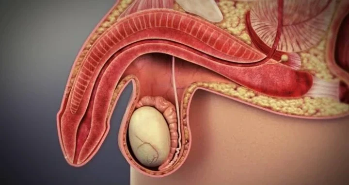 Swollen Prostrate in Men: 5 Foods You Can Eat to Help Shrink Swollen Prostate