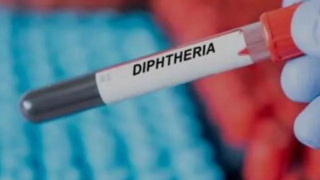 Fresh diphtheria outbreak claims 40 lives in Kano